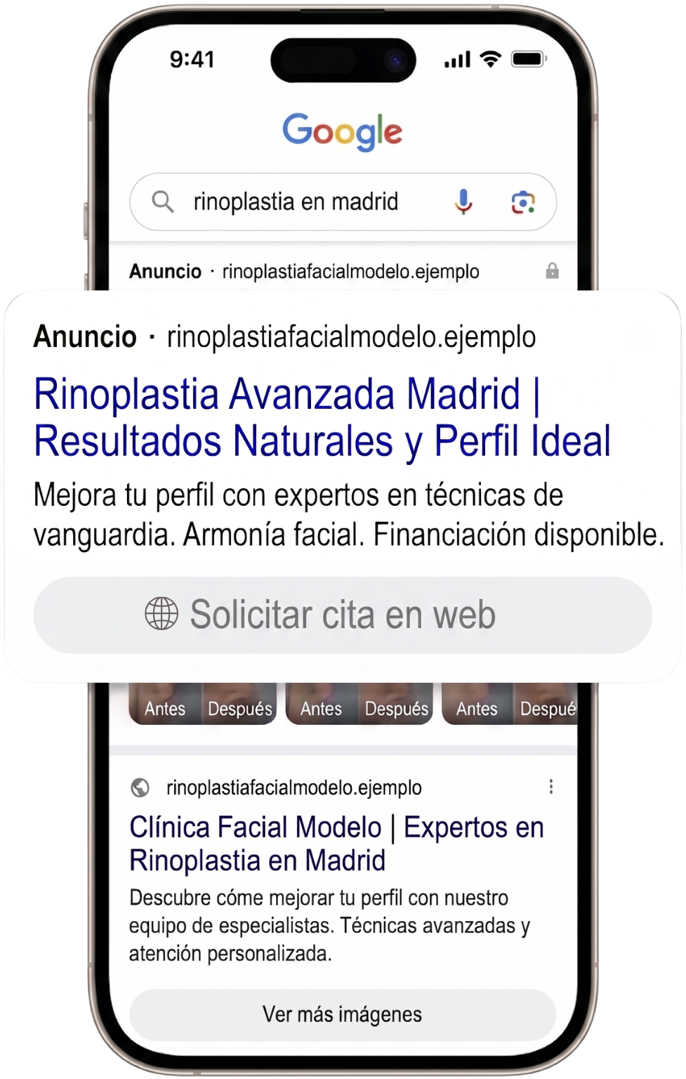 Representación del servicio de anuncios en google para clínicas