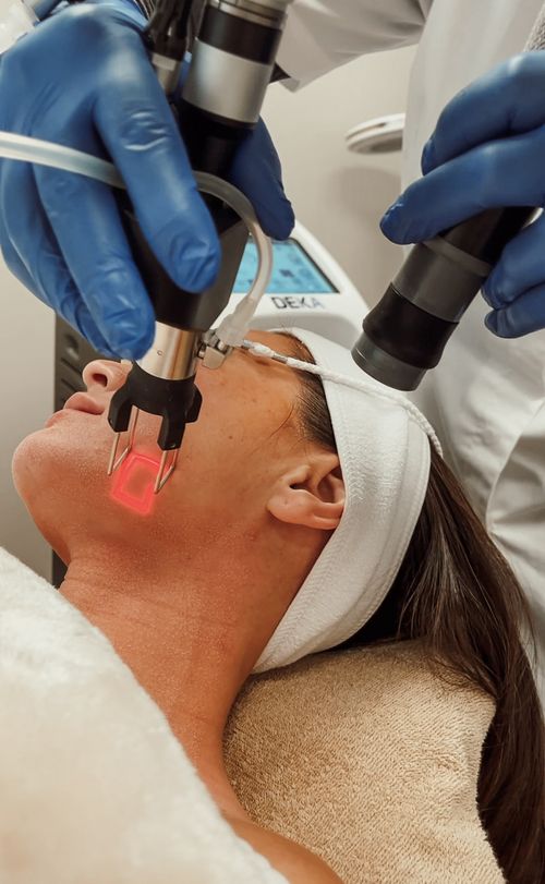 woman receiving microneedling