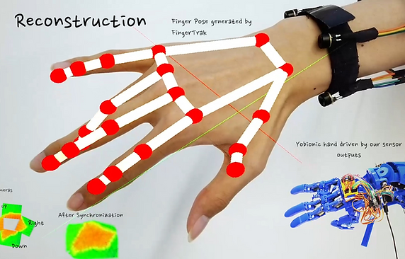 FingerTrak bracelet technical image