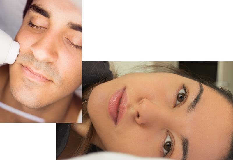 Permanent eyebrow chin lip face laser hair removal