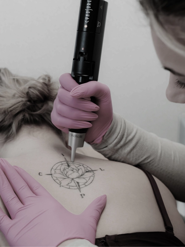 une technicienne de détatouage à laval qui effectue le traitement sur le dos  d'une patiente