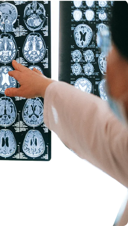 Girl showing X-ray reports