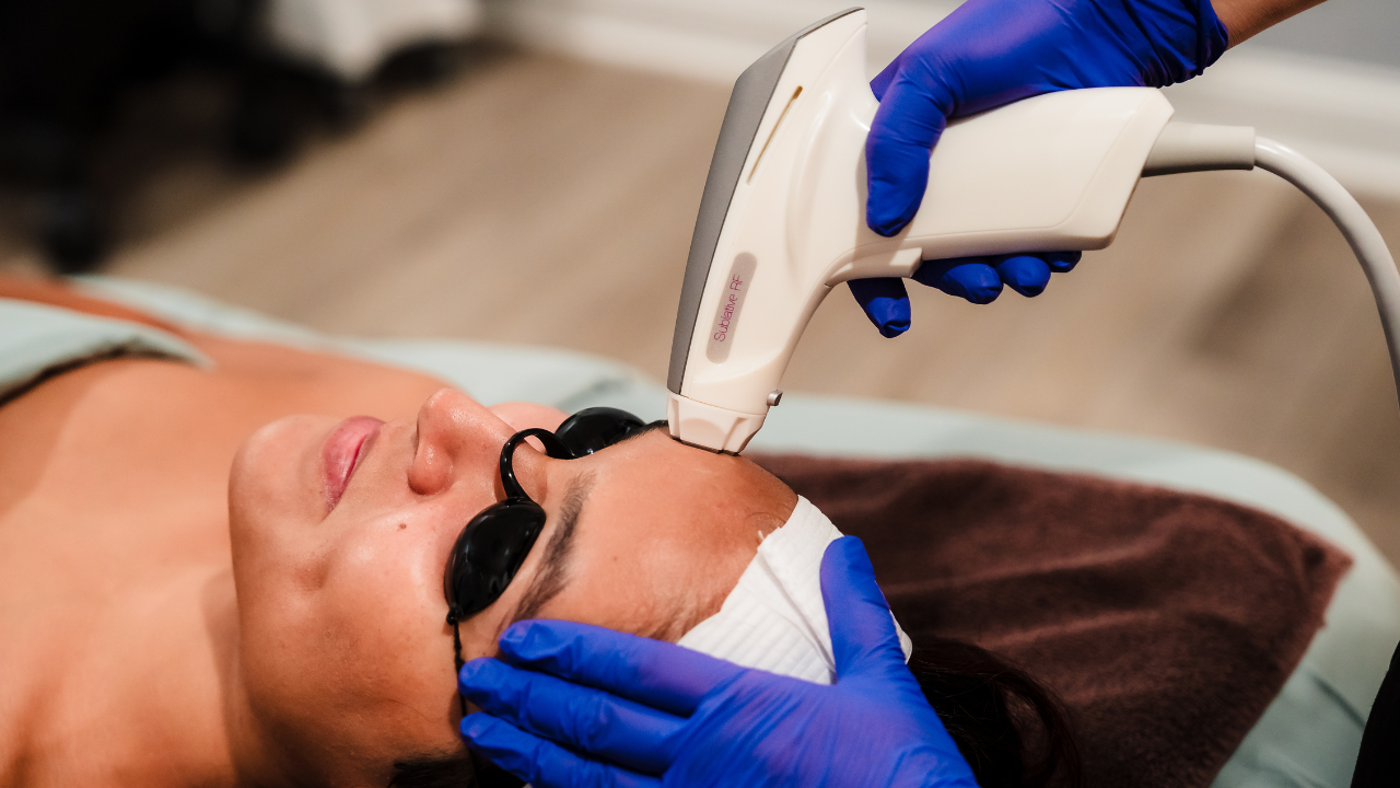 Radio Frequency Skin Resurfacing 