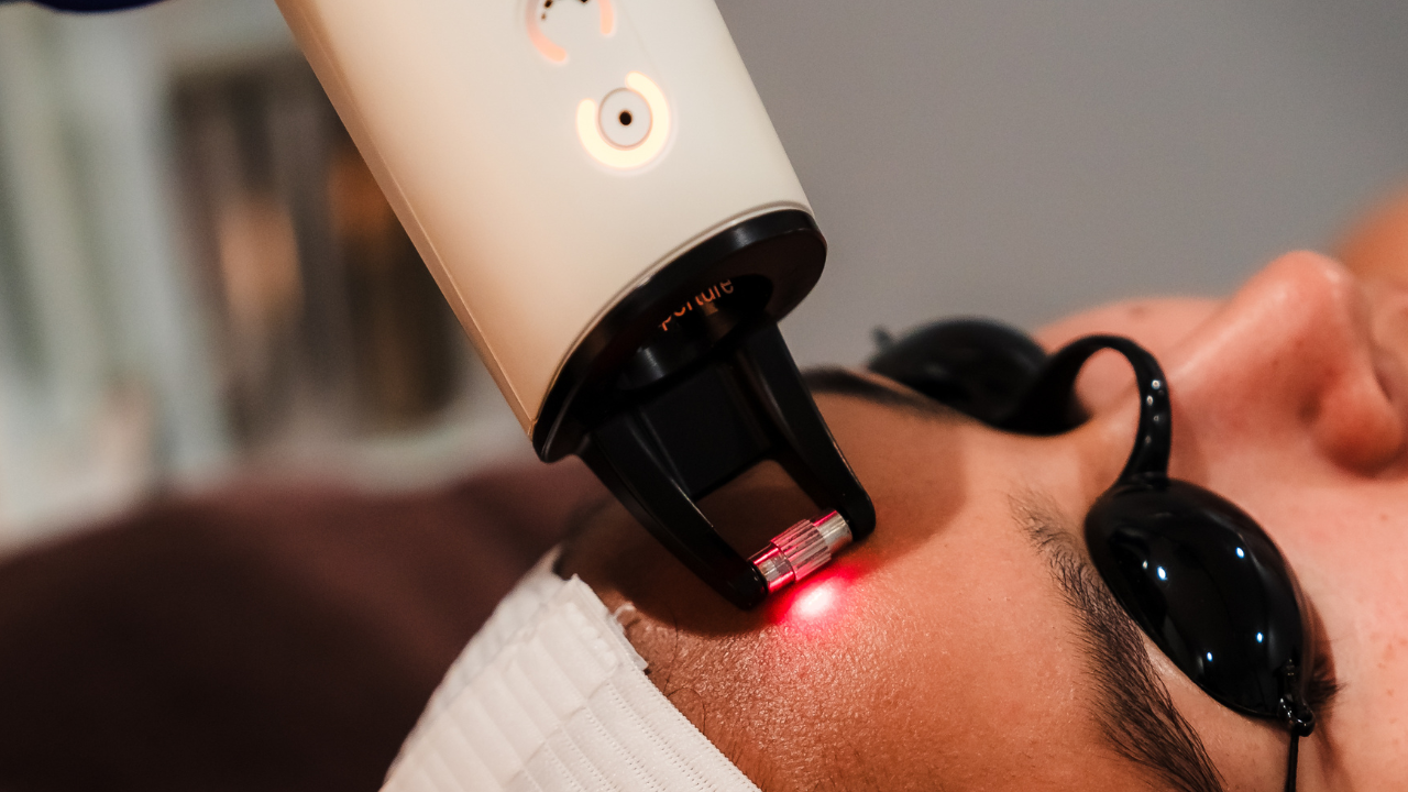 Fraxel Skin Resurfacing 