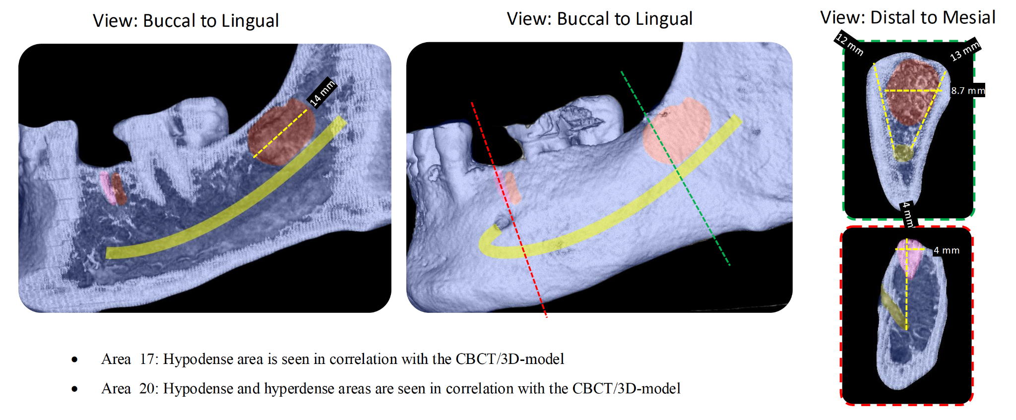 Cavitation Visualization