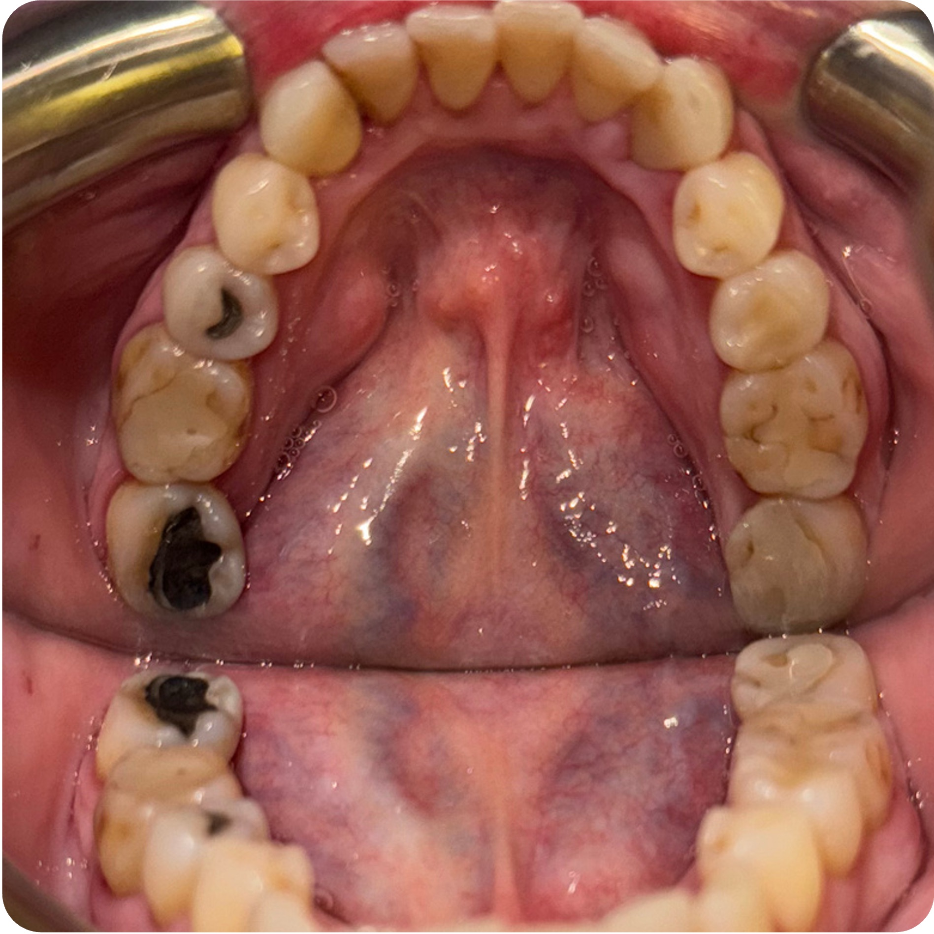 CBCT full visualization for Roberta R on April 29, 2025