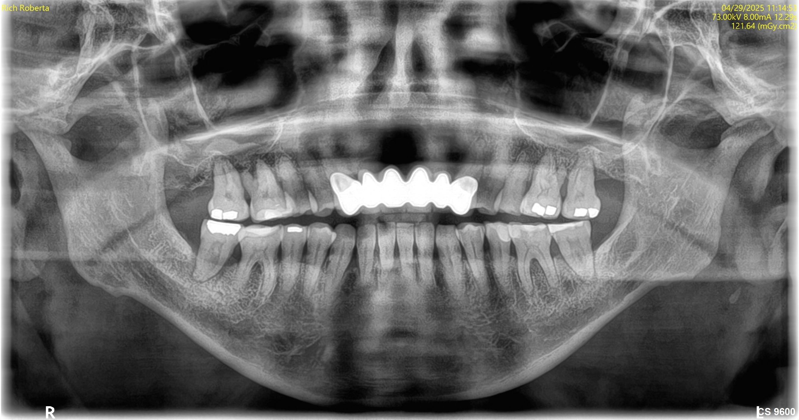 Before treatment photo for Roberta R full-mouth case