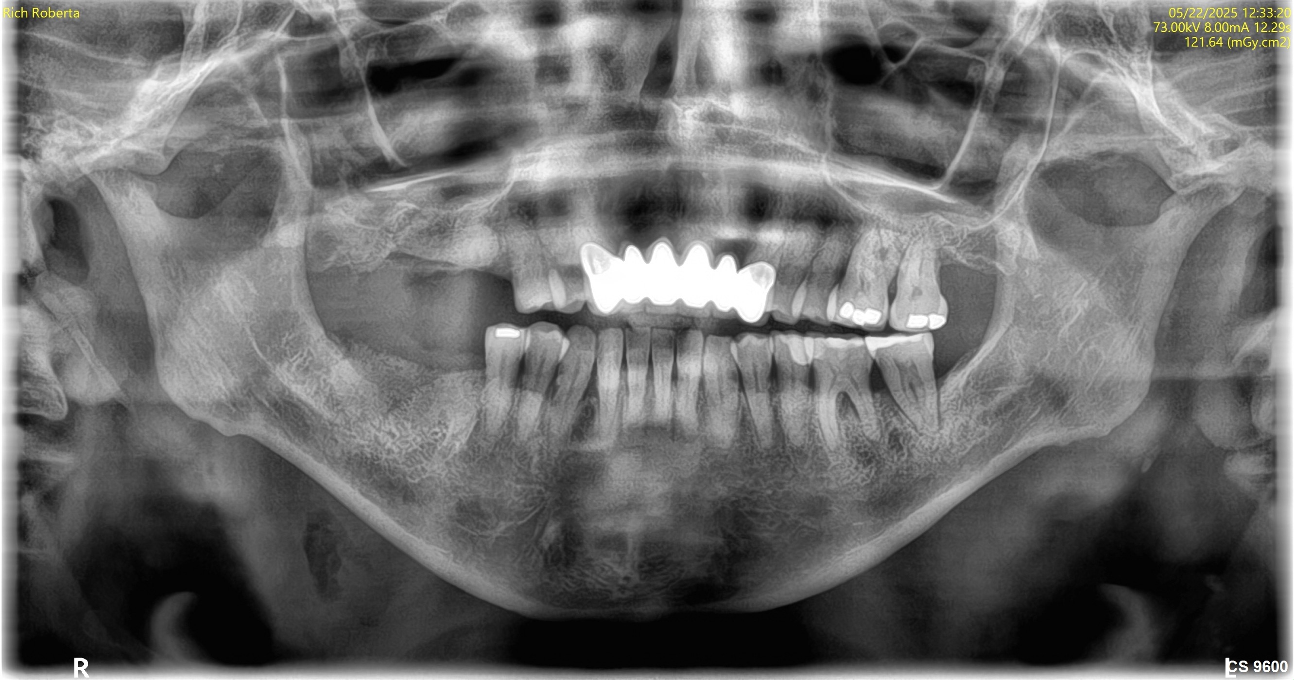 After treatment photo for Roberta R full-mouth case