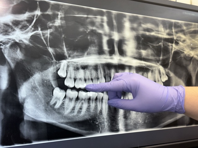 Restorative Dentistry