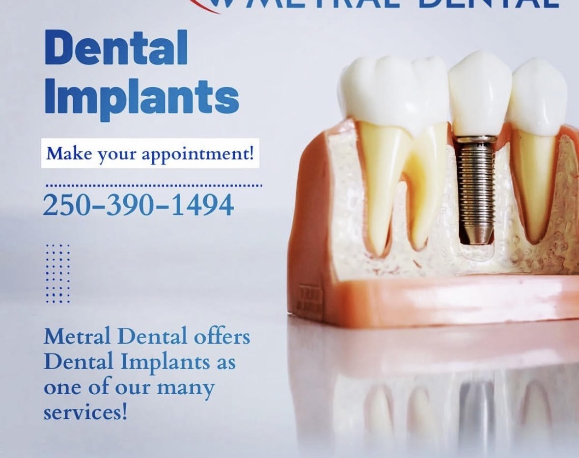Dental Implants in Nanaimo