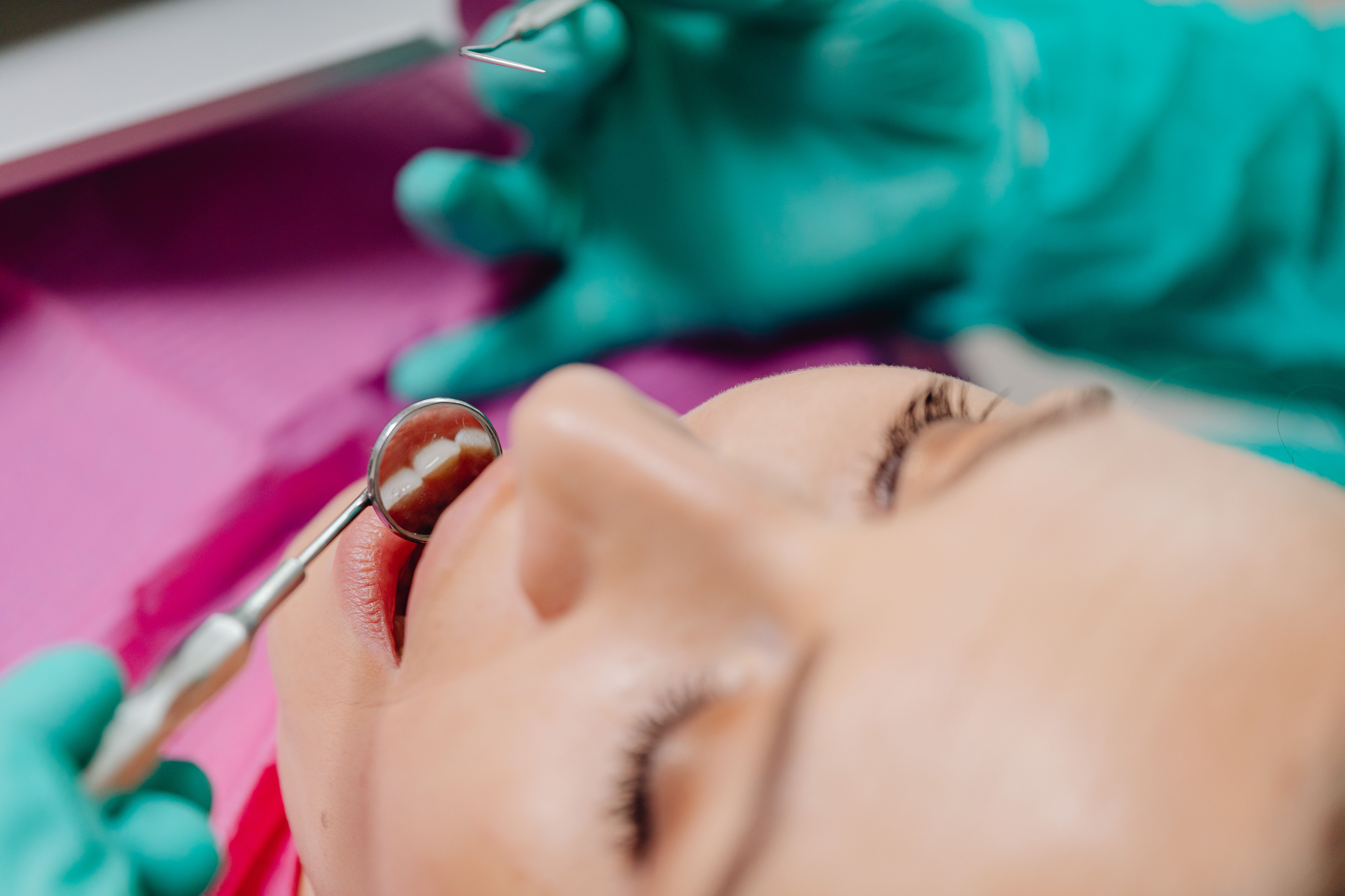 Fillings