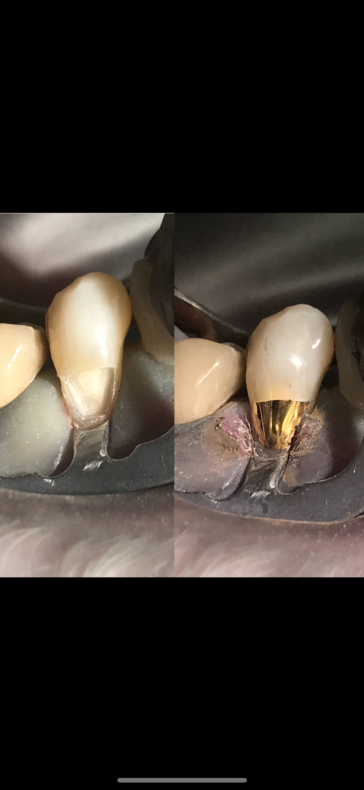 Artistic Dentistry & Gold Foil Restorations