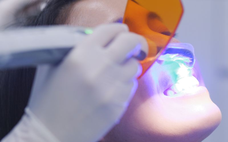 Zabieg laserowy w stomatologii – precyzja i komfort