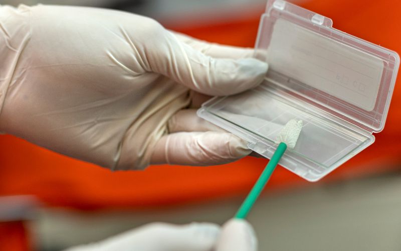 Przenoszenie wymazu cytologicznego na szkiełko laboratoryjne