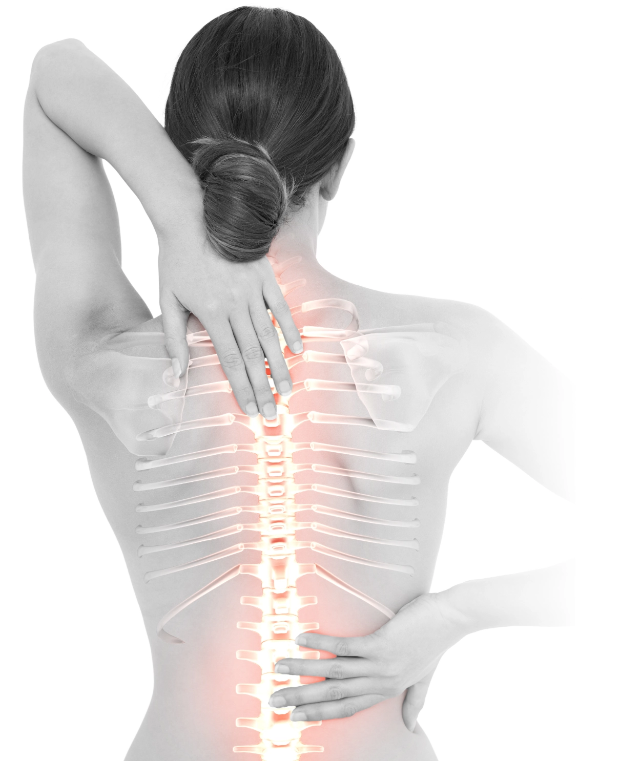 Vertebroplastia