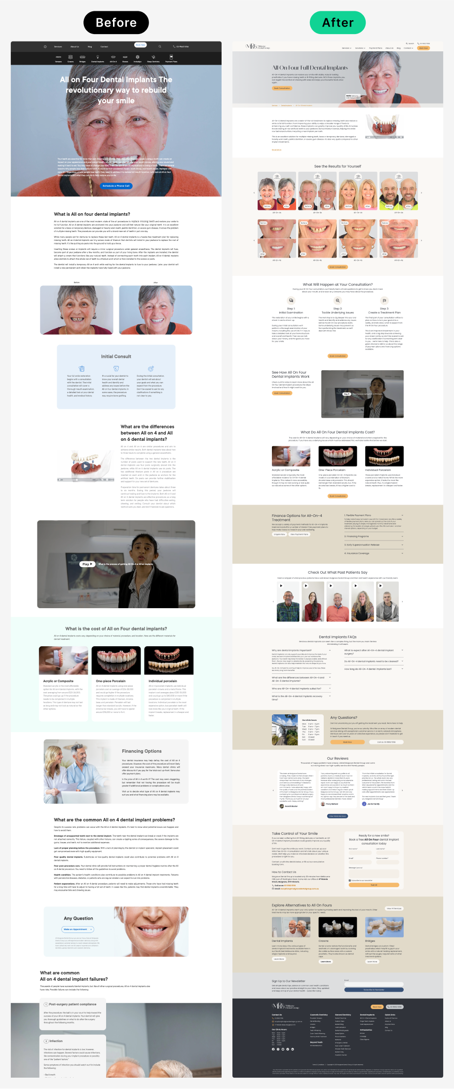 Before and after of the All-On-4 service page.