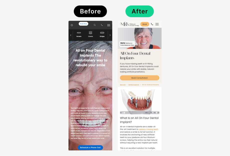Before and after of the mobile All-On-4 service page.