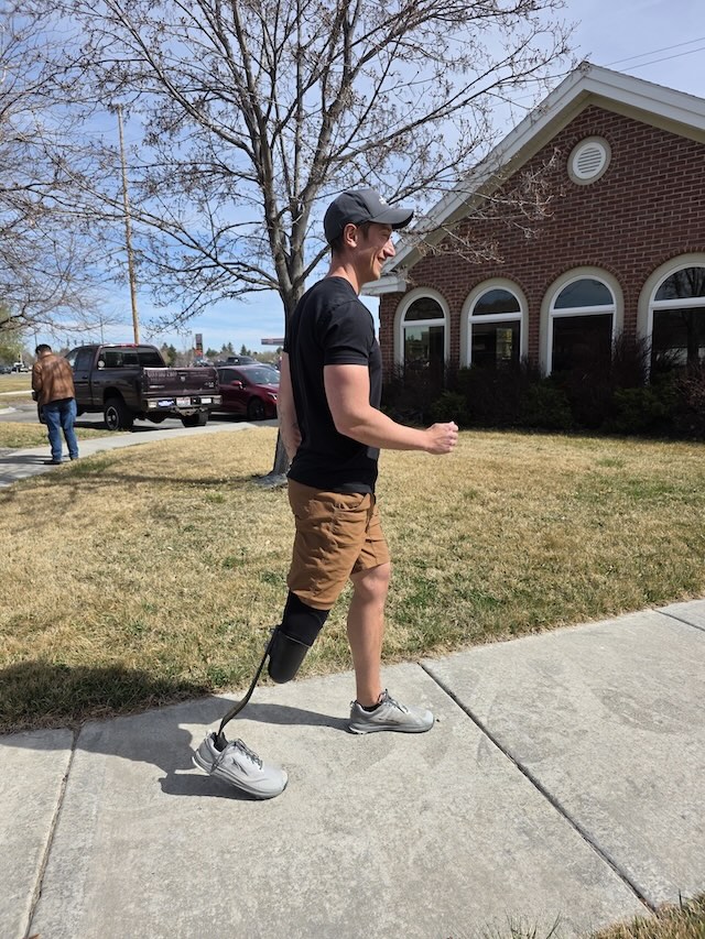 Man with a prosthetic leg walking on a sidewalk near a tree and a brick building on a sunny day.