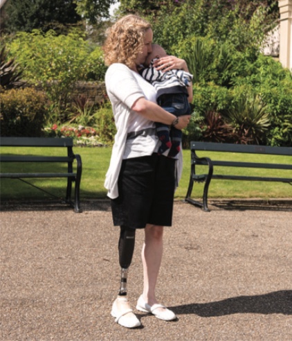 Woman with a prosthetic leg standing outdoors in a garden, holding and comforting a young child.