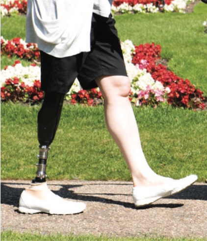 Person walking outdoors on a paved path with a black prosthetic leg and a natural right leg wearing white shoes.