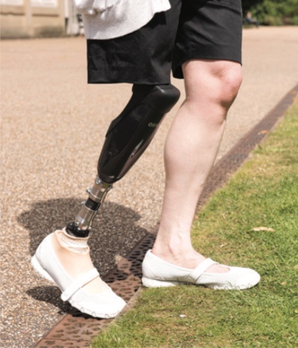 Person with a prosthetic leg stepping from pavement onto grass, wearing white slip-on shoes and black shorts.