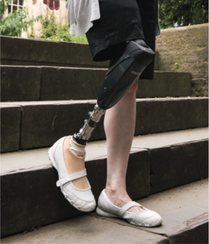 Person with a black prosthetic leg walking down stone stairs, wearing white shoes and black shorts.