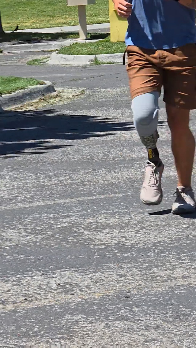 Person running on pavement wearing a prosthetic leg and brown shorts with white sneakers.