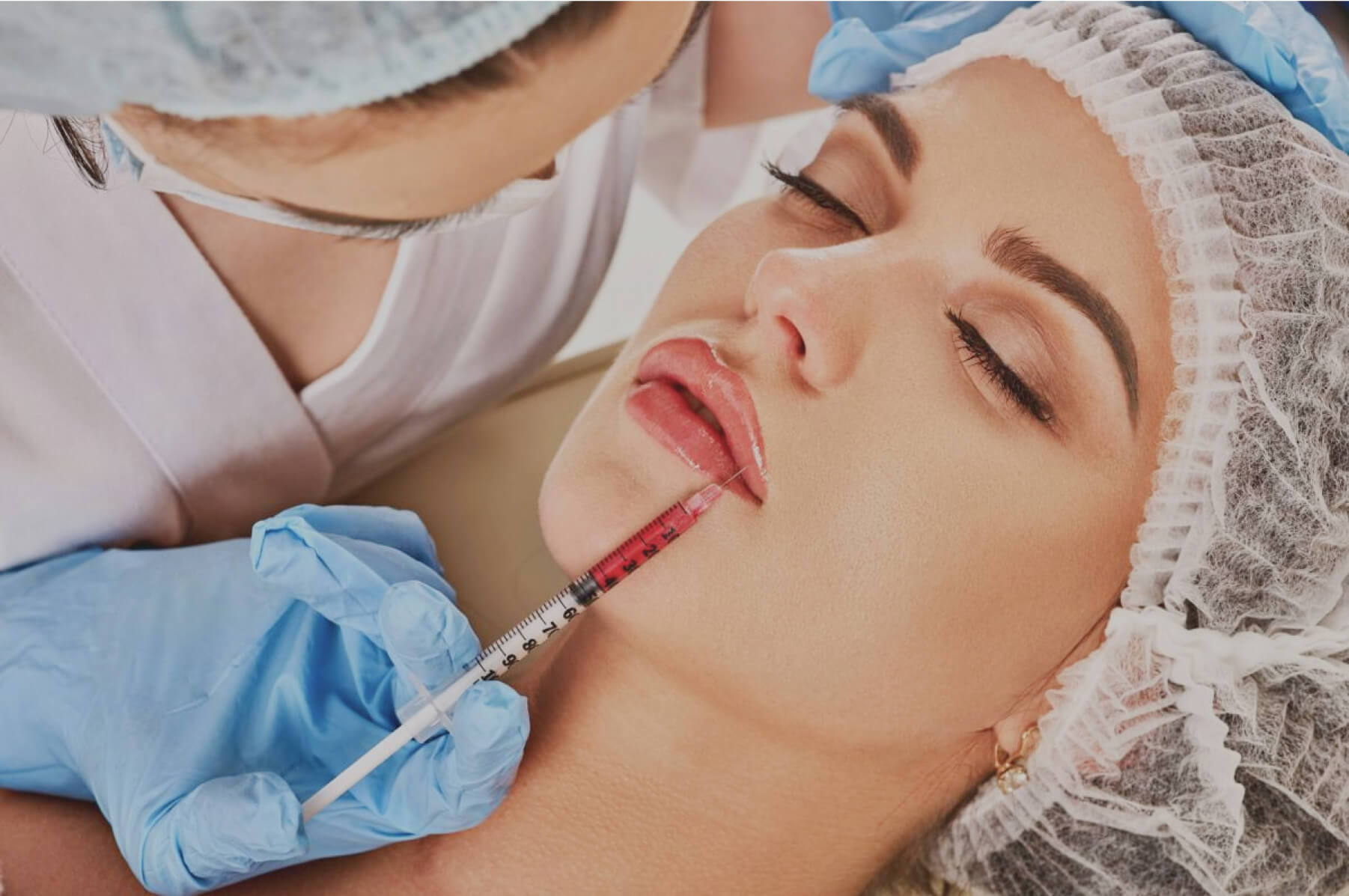 dermal-fillers