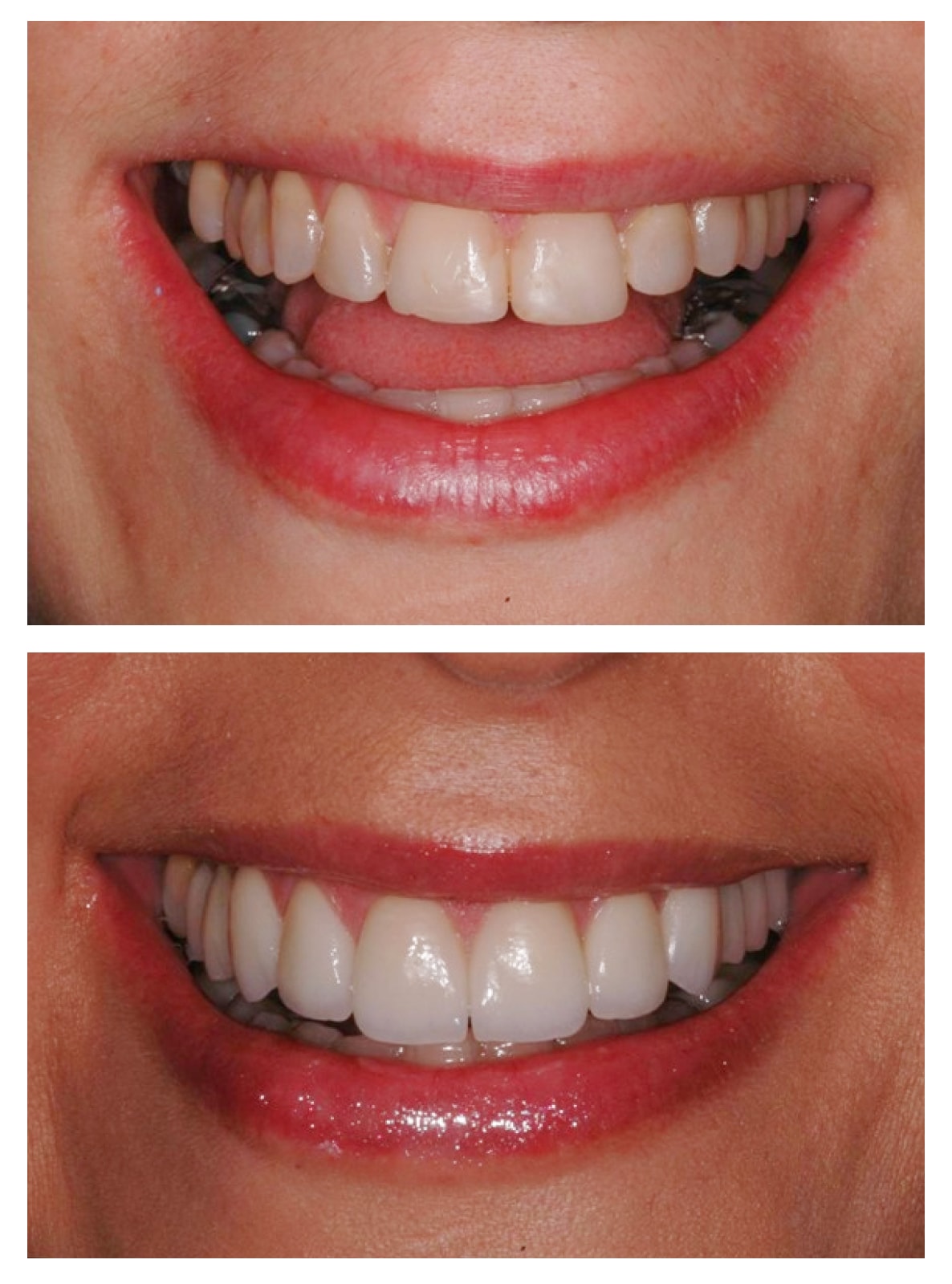 Dental treatment before and after