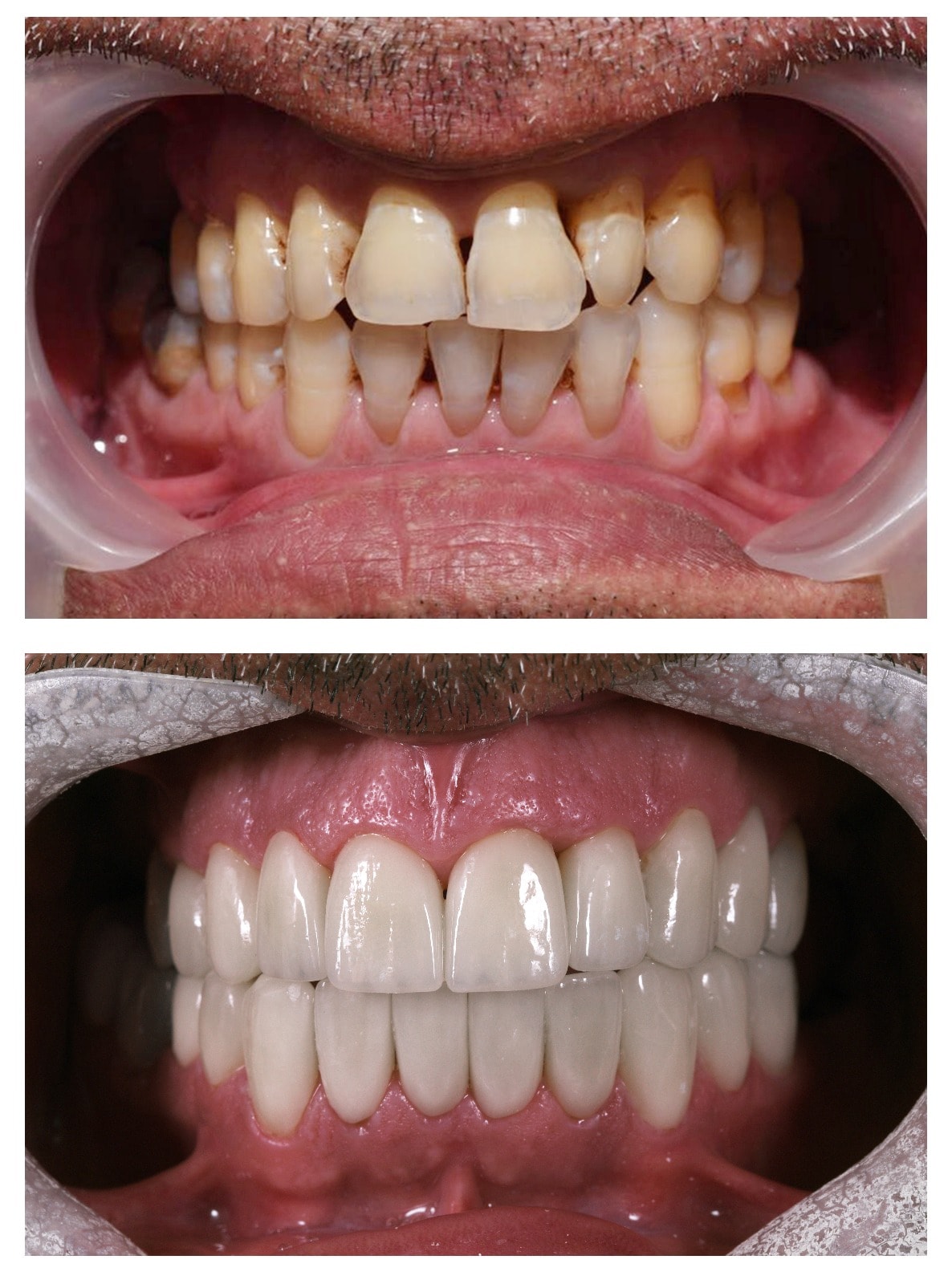 Smile transformation