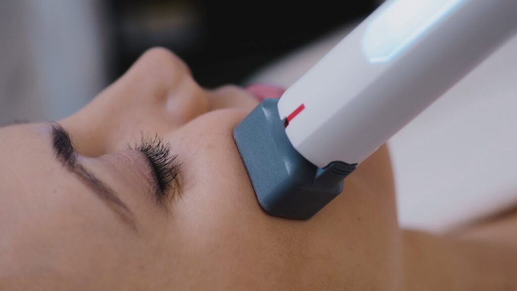 Laser Hair Removal Winnipeg