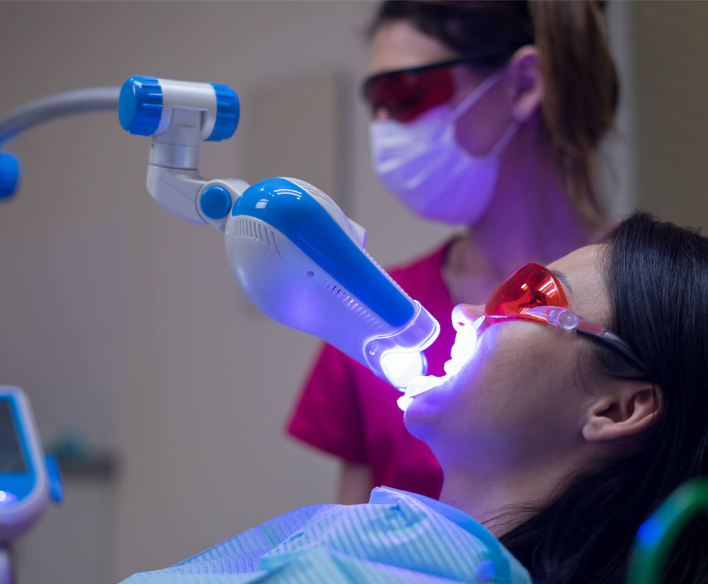blanchiment des dents