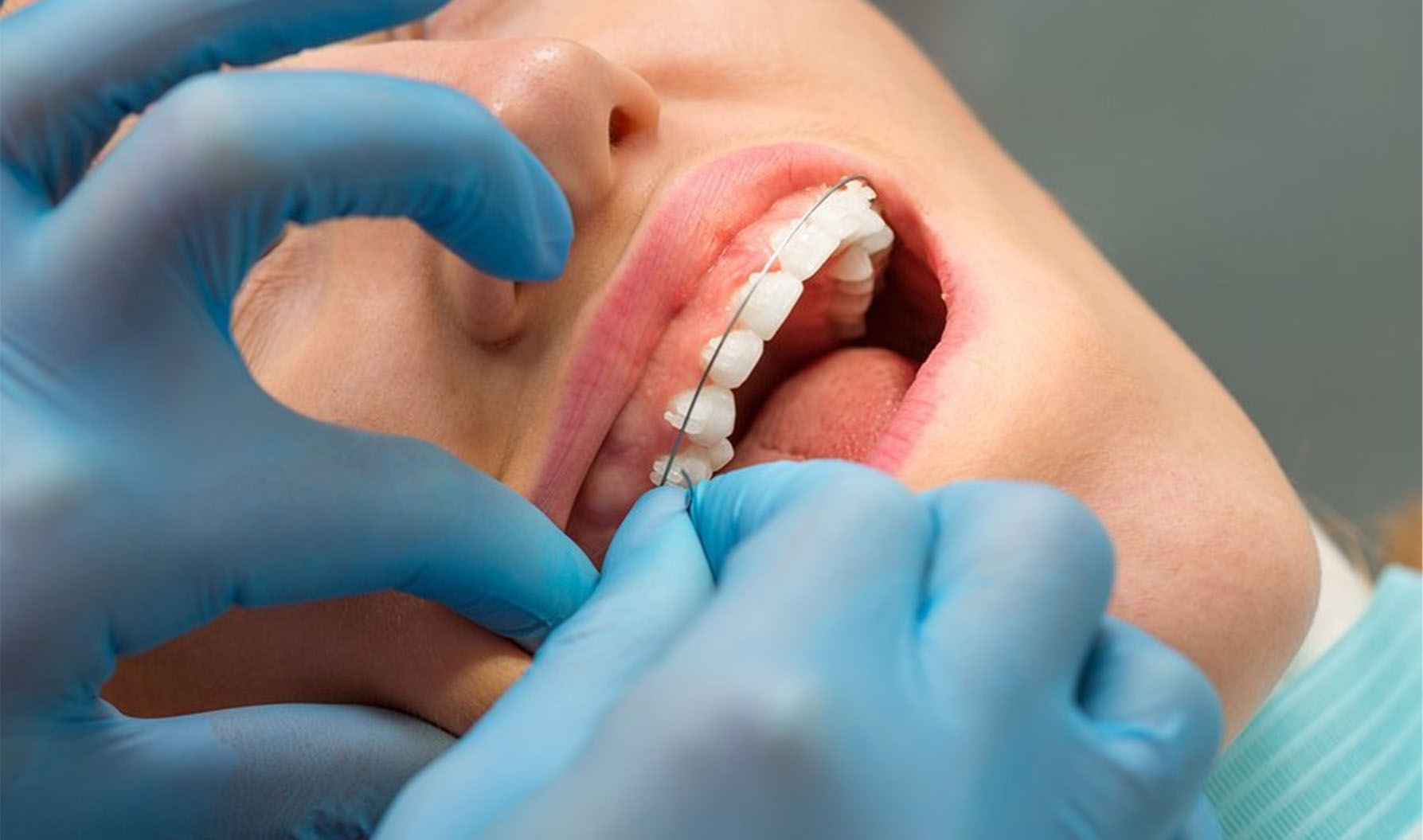 Un sourire pour la vie : La chronique du Dr. Méthot
