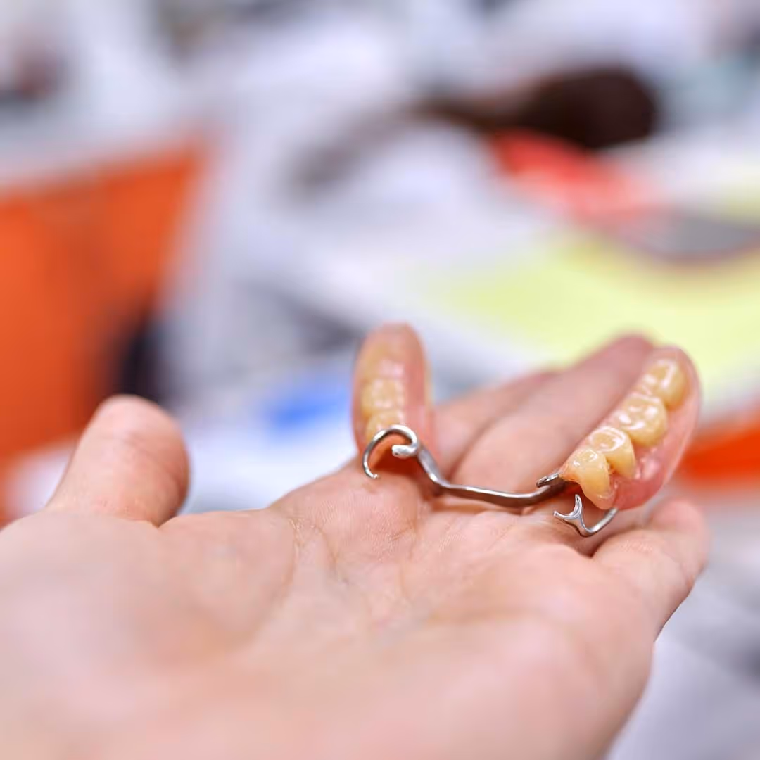 Someone holding partial removable denture in their hand