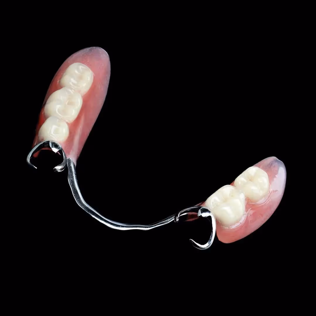 Metal partial dentures example
