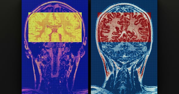 Kein Gehirn ist neurotypisch