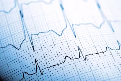 Formação em ECG
