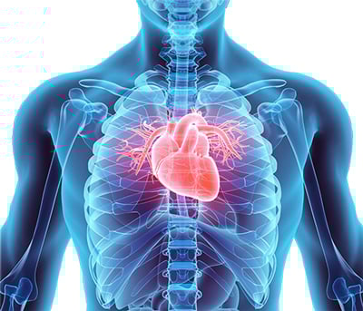A fellow diver suggested the patient was tested for PFO