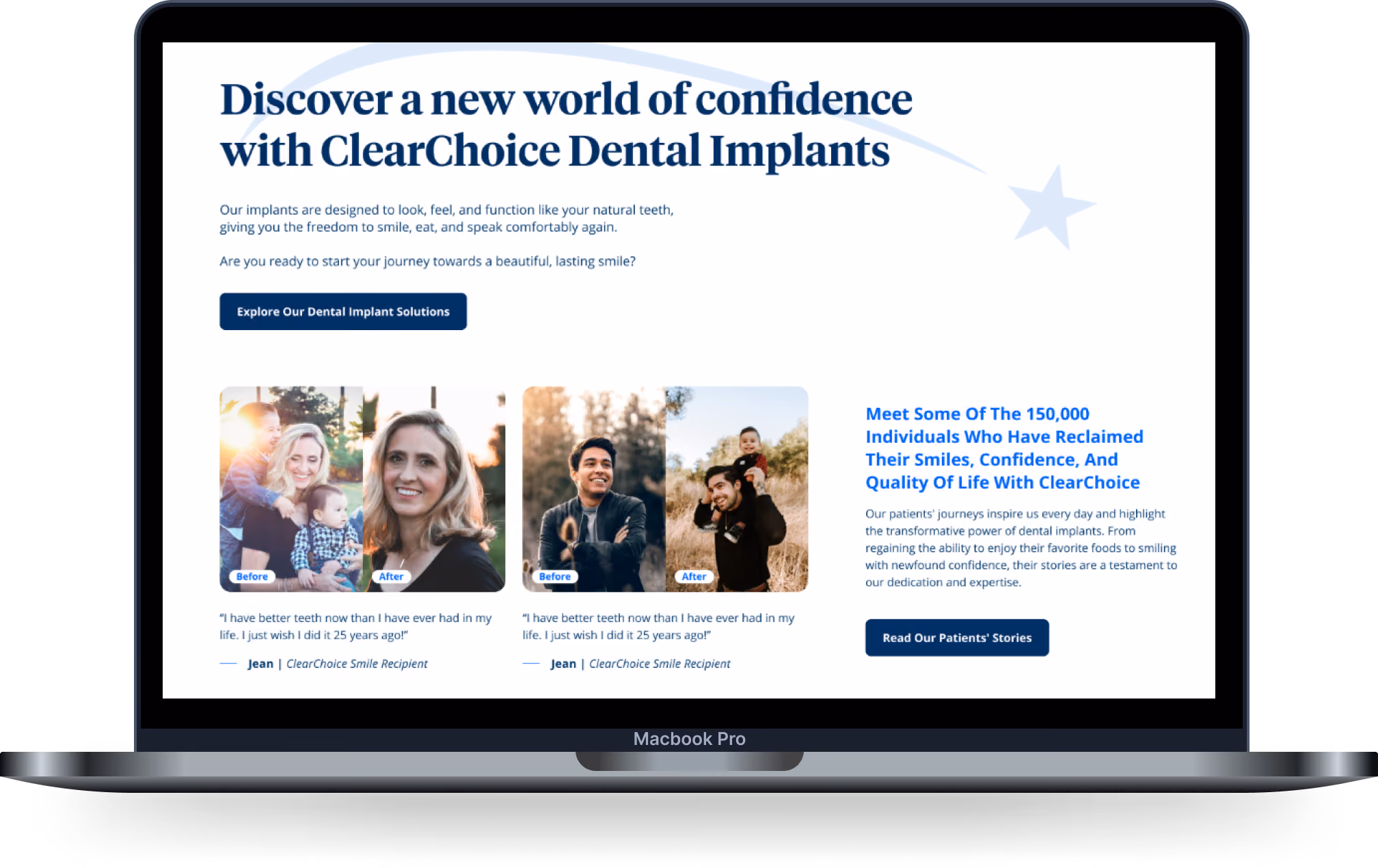 Clear Choice case study