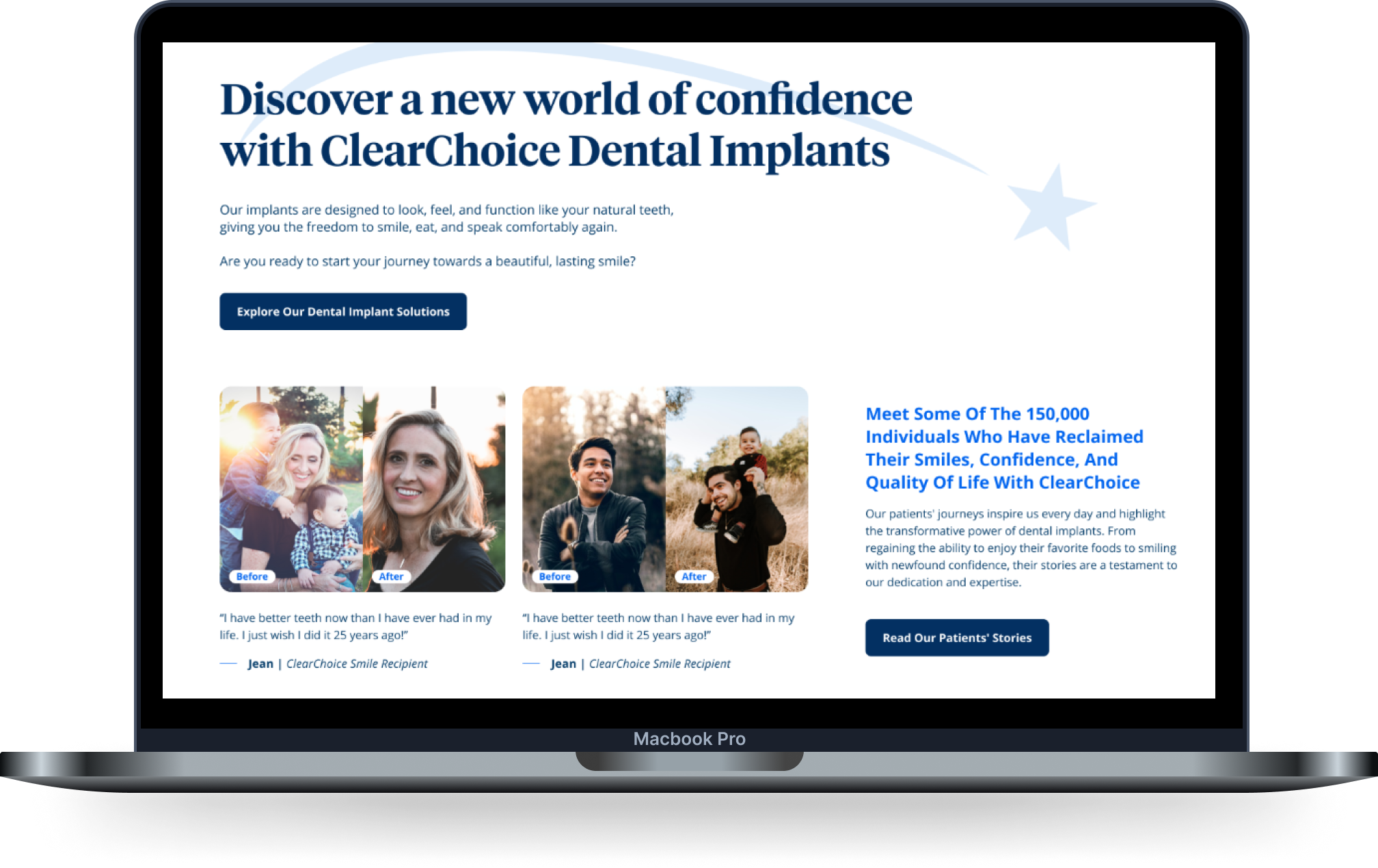 Clear Choice case study