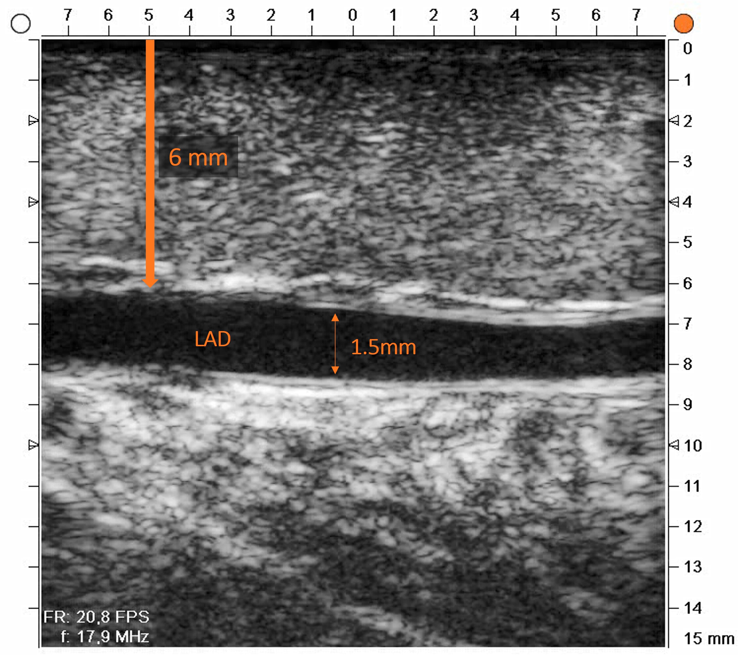Captured image of a medical procedure