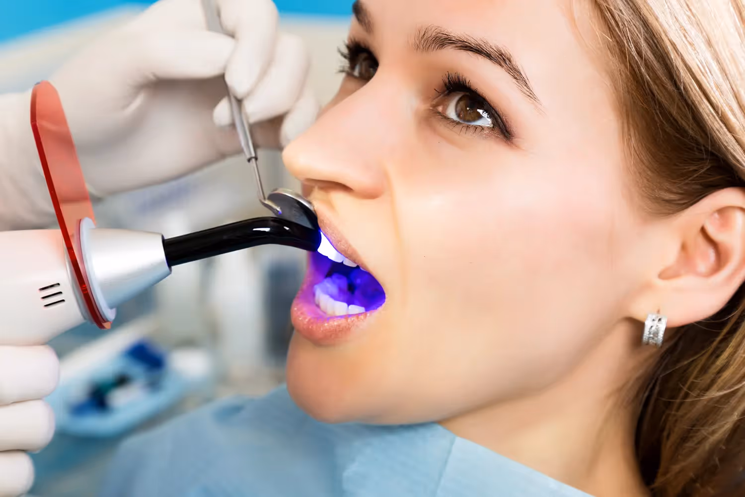 Does Tooth Bonding Hurt?