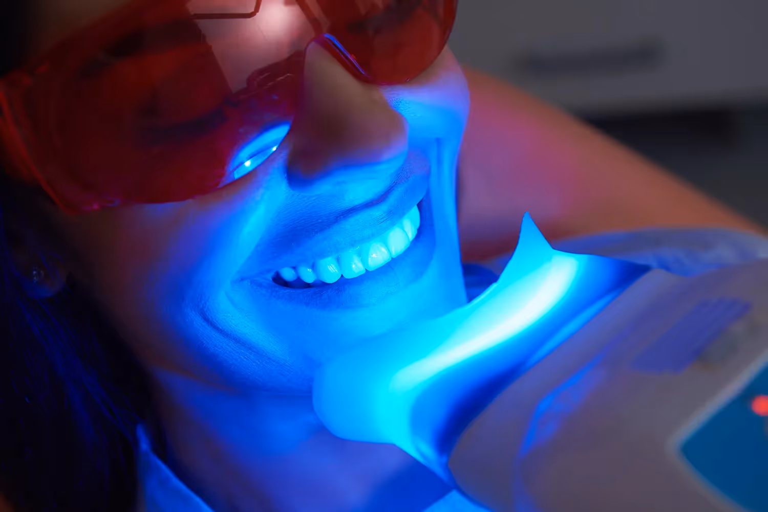 Teeth Whitening in Kearny Mesa