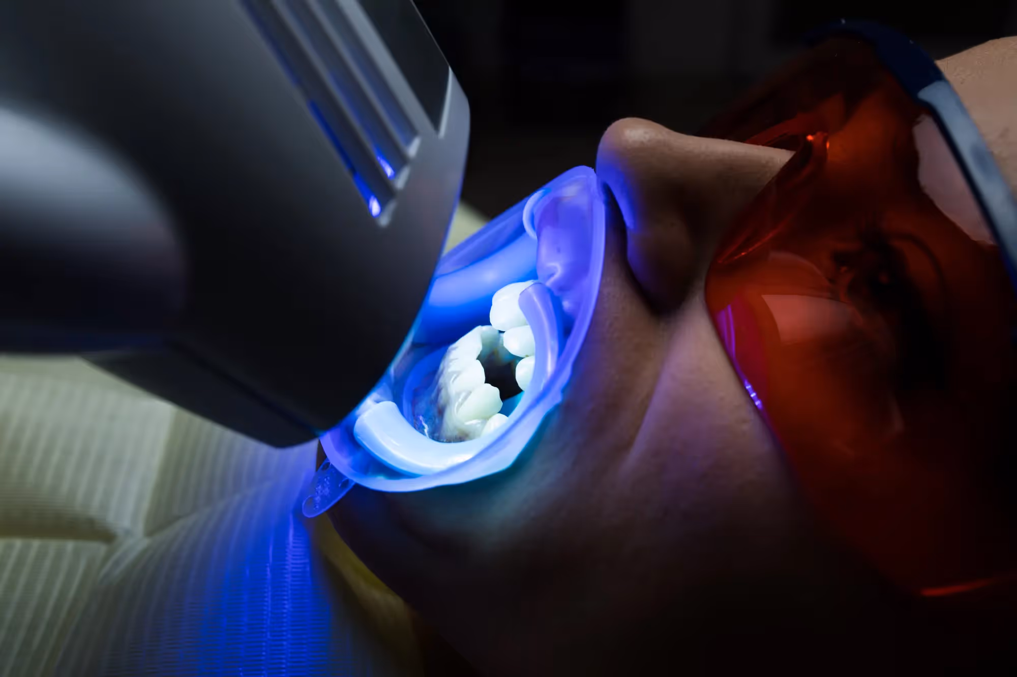 In-Office vs. Take-Home: Choosing Your Best Teeth Whitening Option
