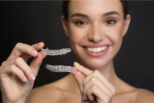 What are retainers?