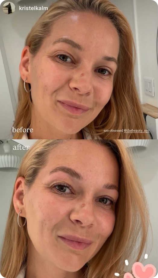 Close-up before and after images of a woman showing skin and eyebrow enhancement effects.