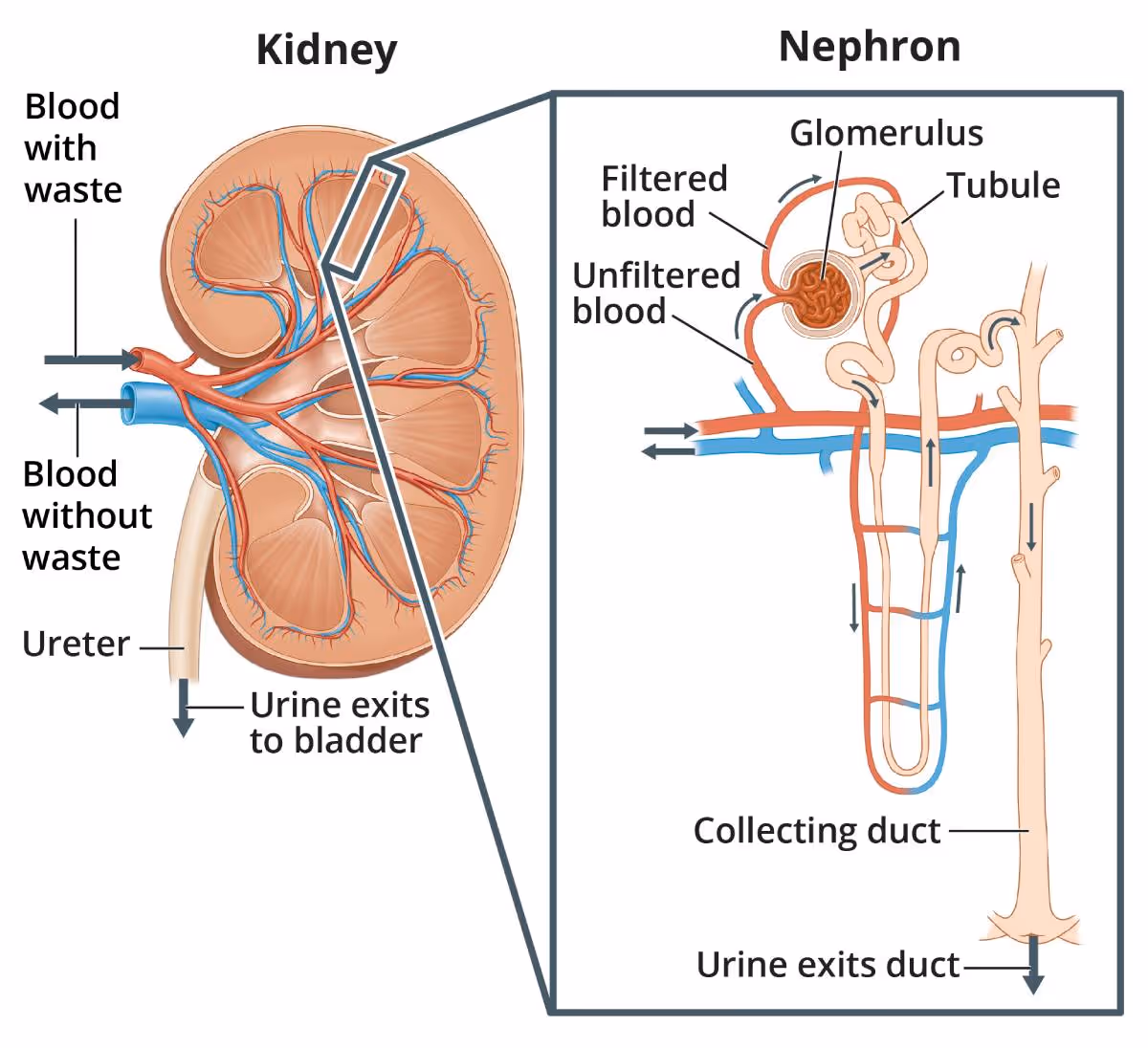 Un diagramma anatomico di un rene che mostra un'immagine ingrandita di un nefrone per mostrare il sangue che viene filtrato nel glomerulo.