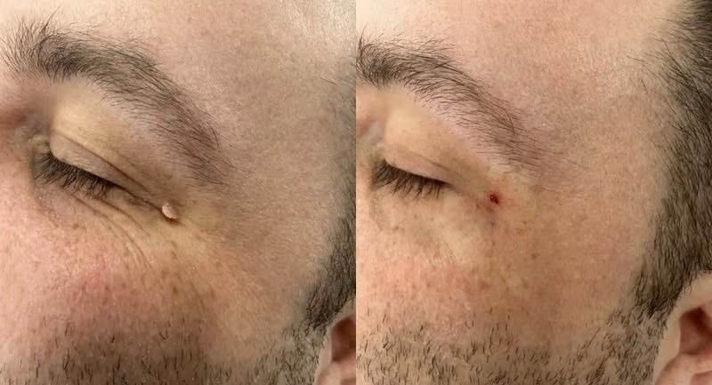AL Aesthetics Before After Results