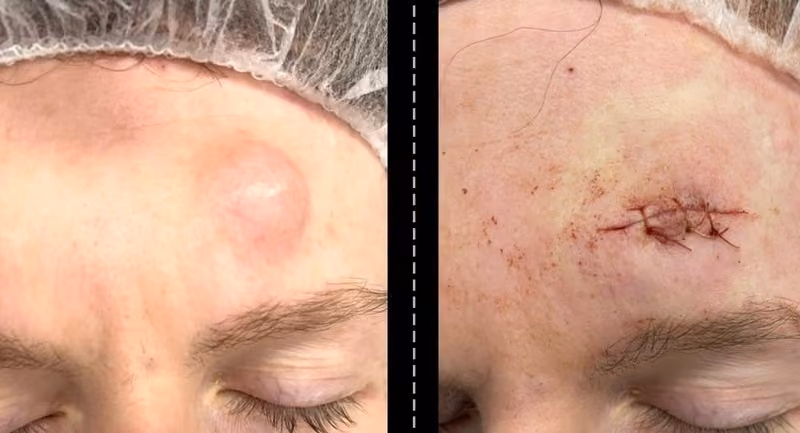 AL Aesthetics Before After Results