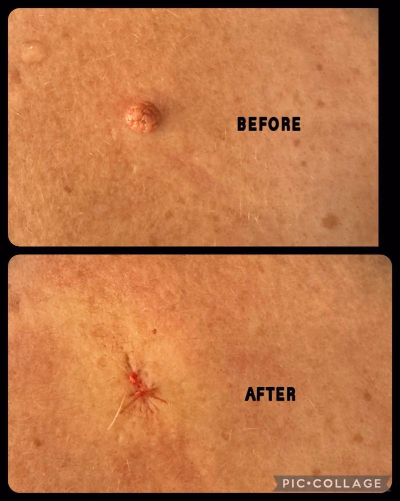 Treatments by Dr Ash Labib